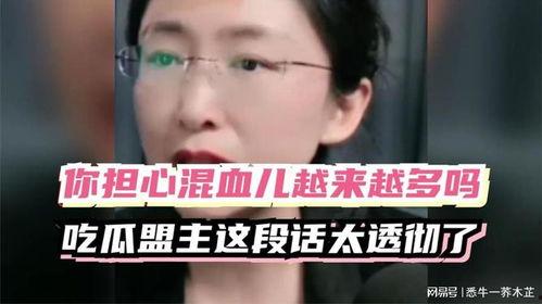 吃瓜蒙主混血,揭秘神秘混血儿的成长故事  第2张